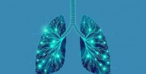 IA e Medicina: Tratamento Inovador para Doenças Pulmonares